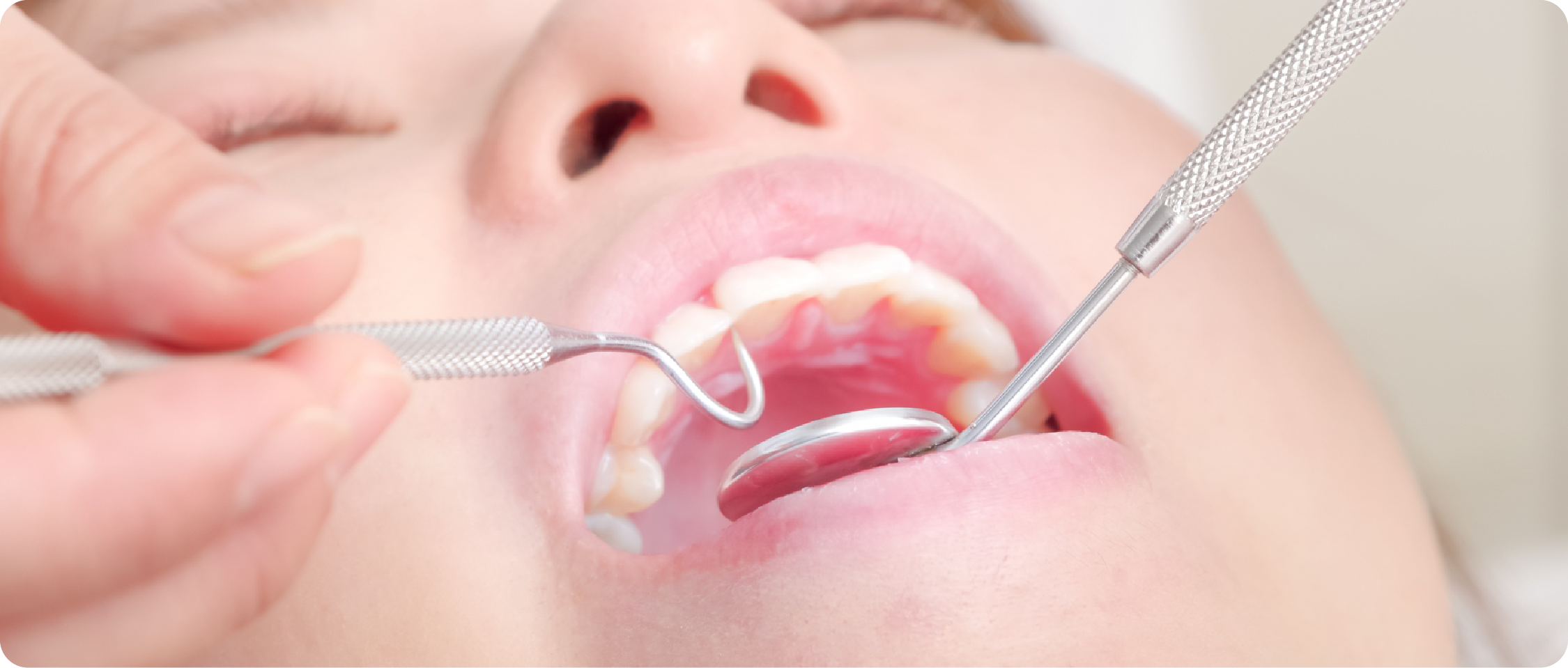 一般歯科について