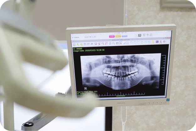 モニターシステム